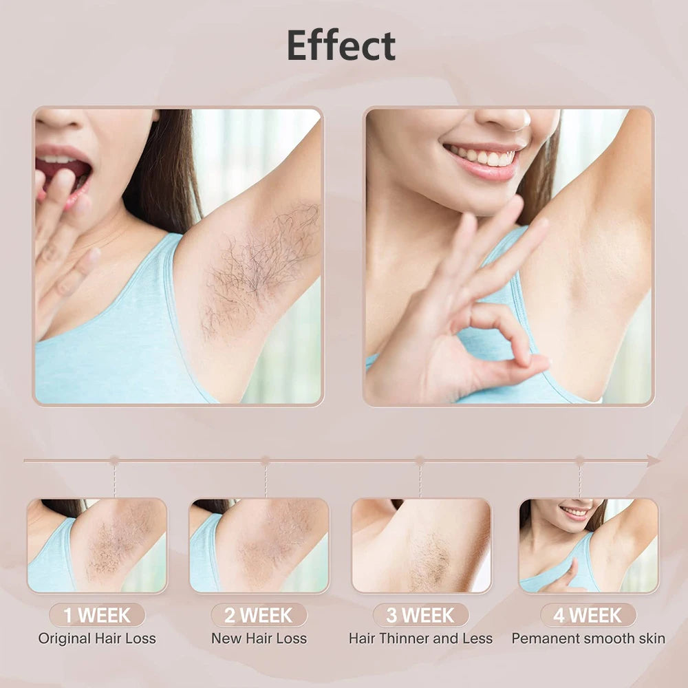 Laser Epilator IPL Hair Removal for Women