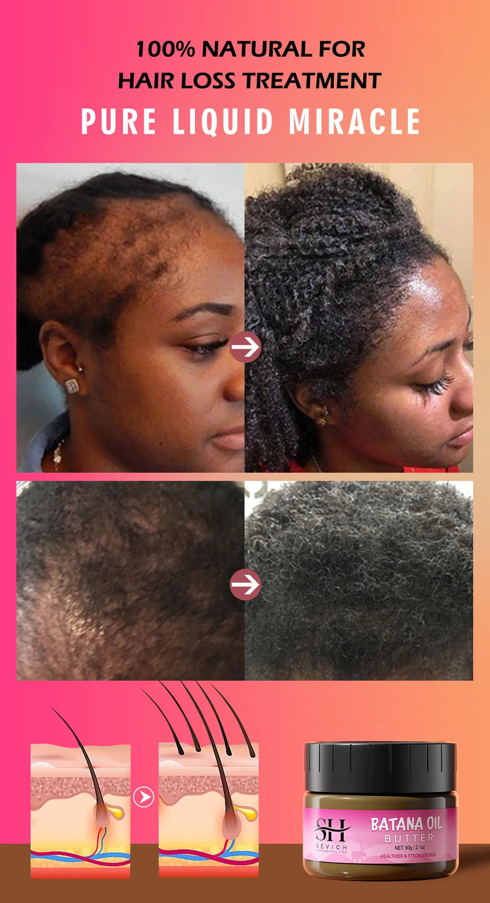 100% Pure Batana Oil for Hair Growth