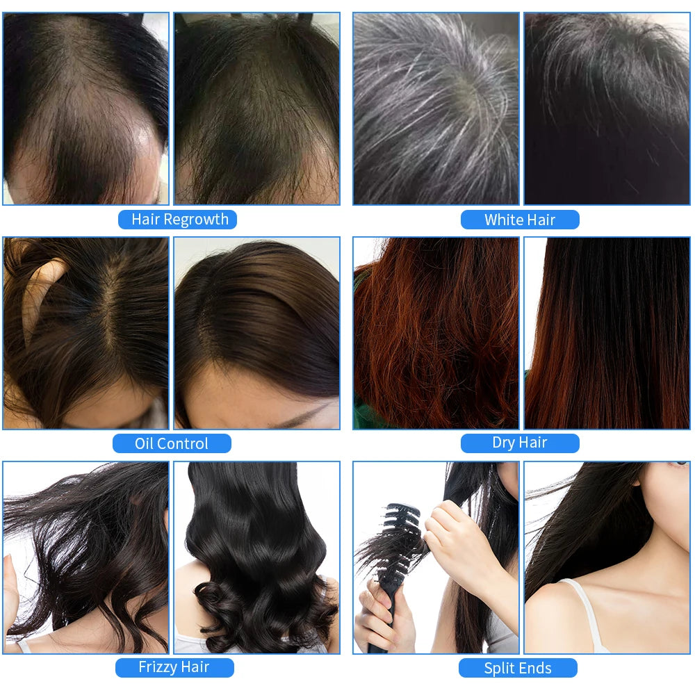 EMS Electric Scalp Massager – LED Hair Growth & Anti-Hair Loss Comb