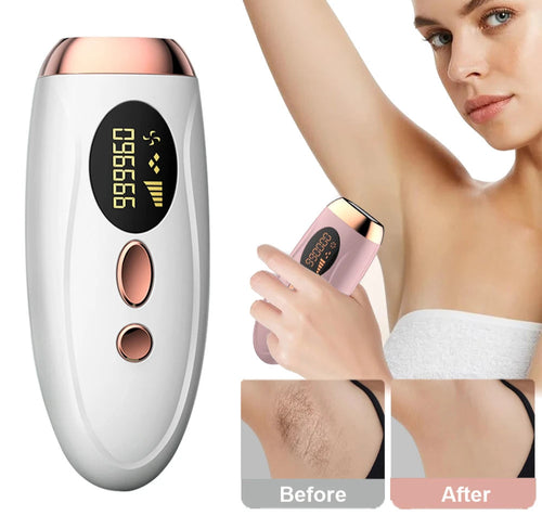 Laser Epilator IPL Hair Removal for Women