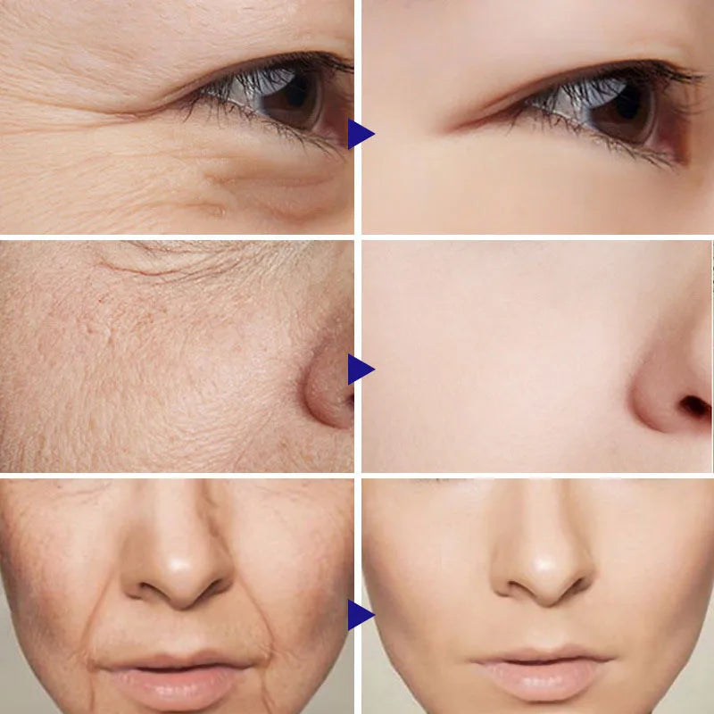 Retinol Face Cream – Anti-Aging, Firming & Wrinkle Removal Moisturizer