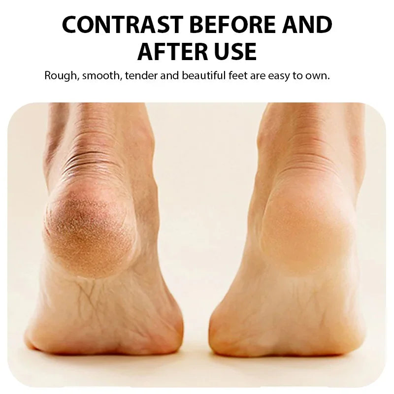 Electric Foot Grinder – Callus Remover & Dead Skin Scrubber