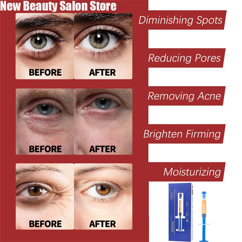 Retinol Face Cream – Anti-Aging, Firming & Wrinkle Removal Moisturizer