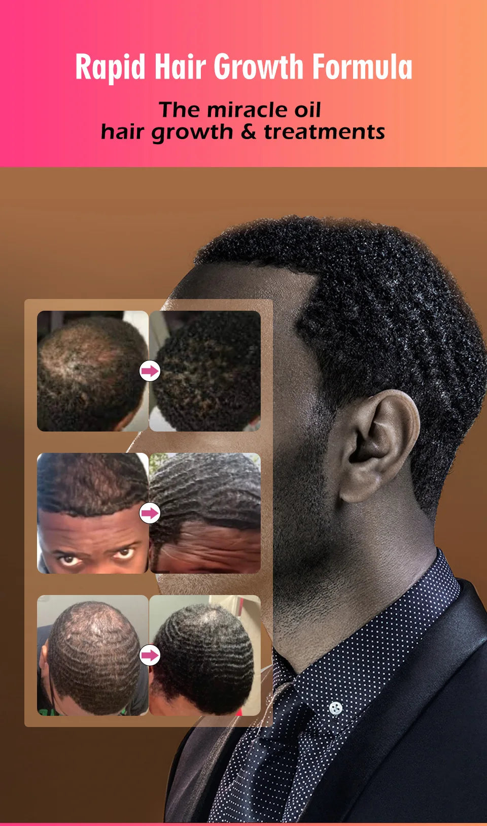 100% Pure Batana Oil for Hair Growth