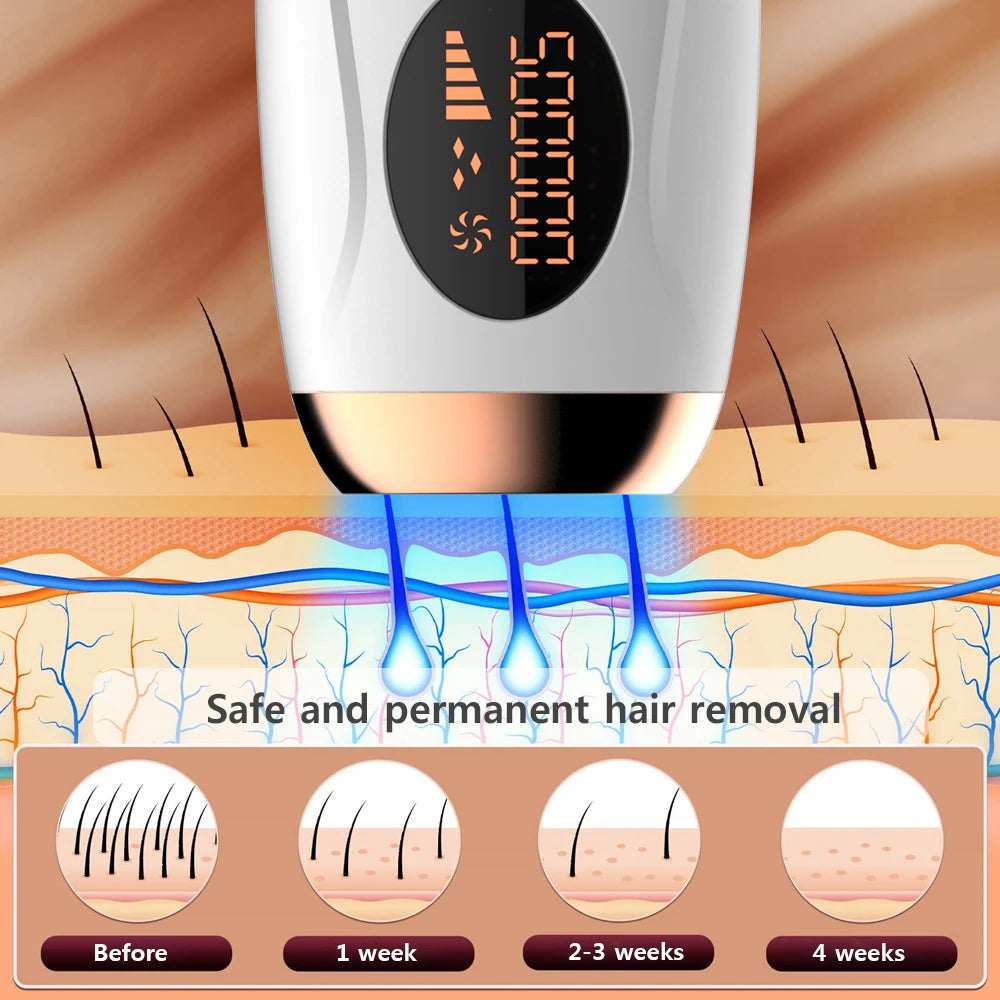 Laser Epilator IPL Hair Removal for Women