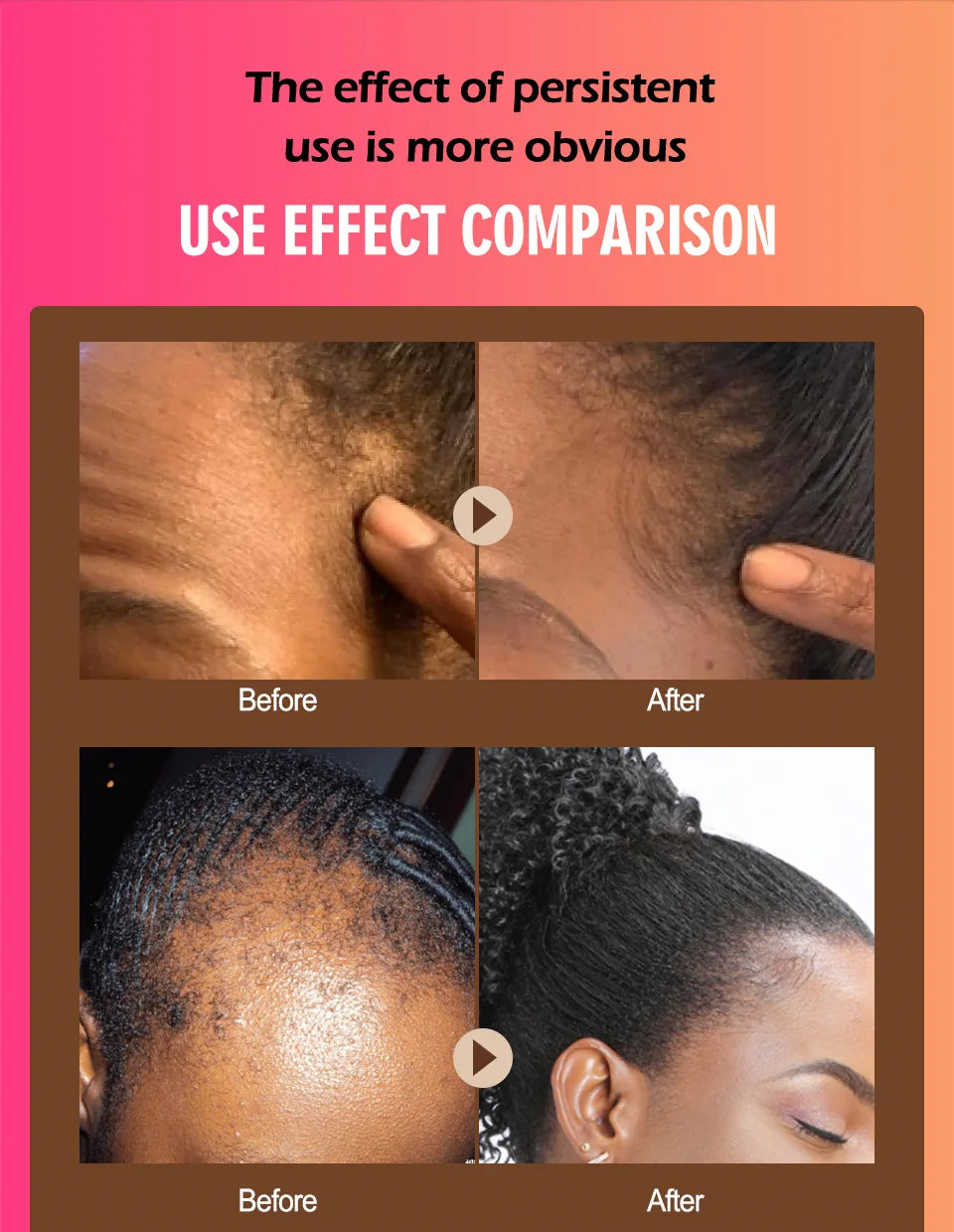 100% Pure Batana Oil for Hair Growth