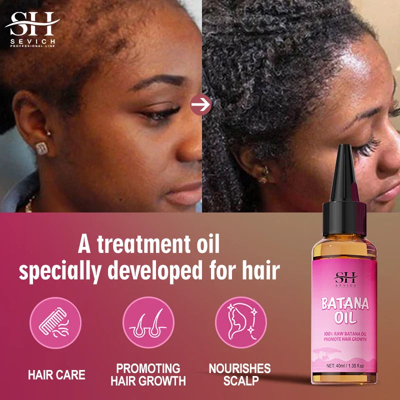 100% Pure Batana Oil for Hair Growth