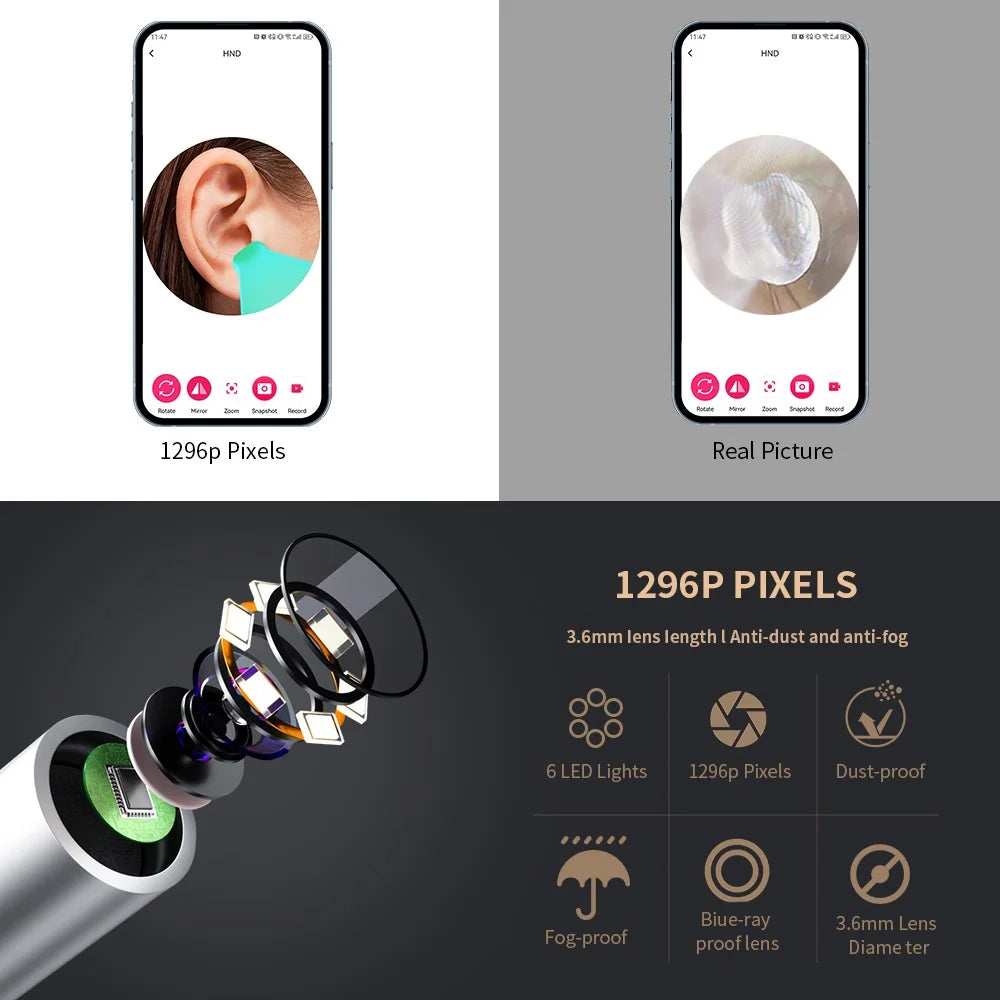 Smart Visual Ear Cleaner with Camera & LED Light for Ear Wax Removal