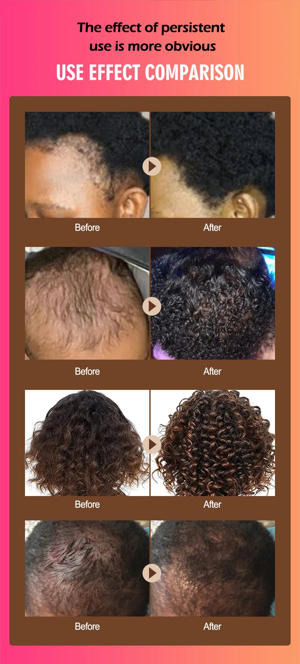 100% Pure Batana Oil for Hair Growth