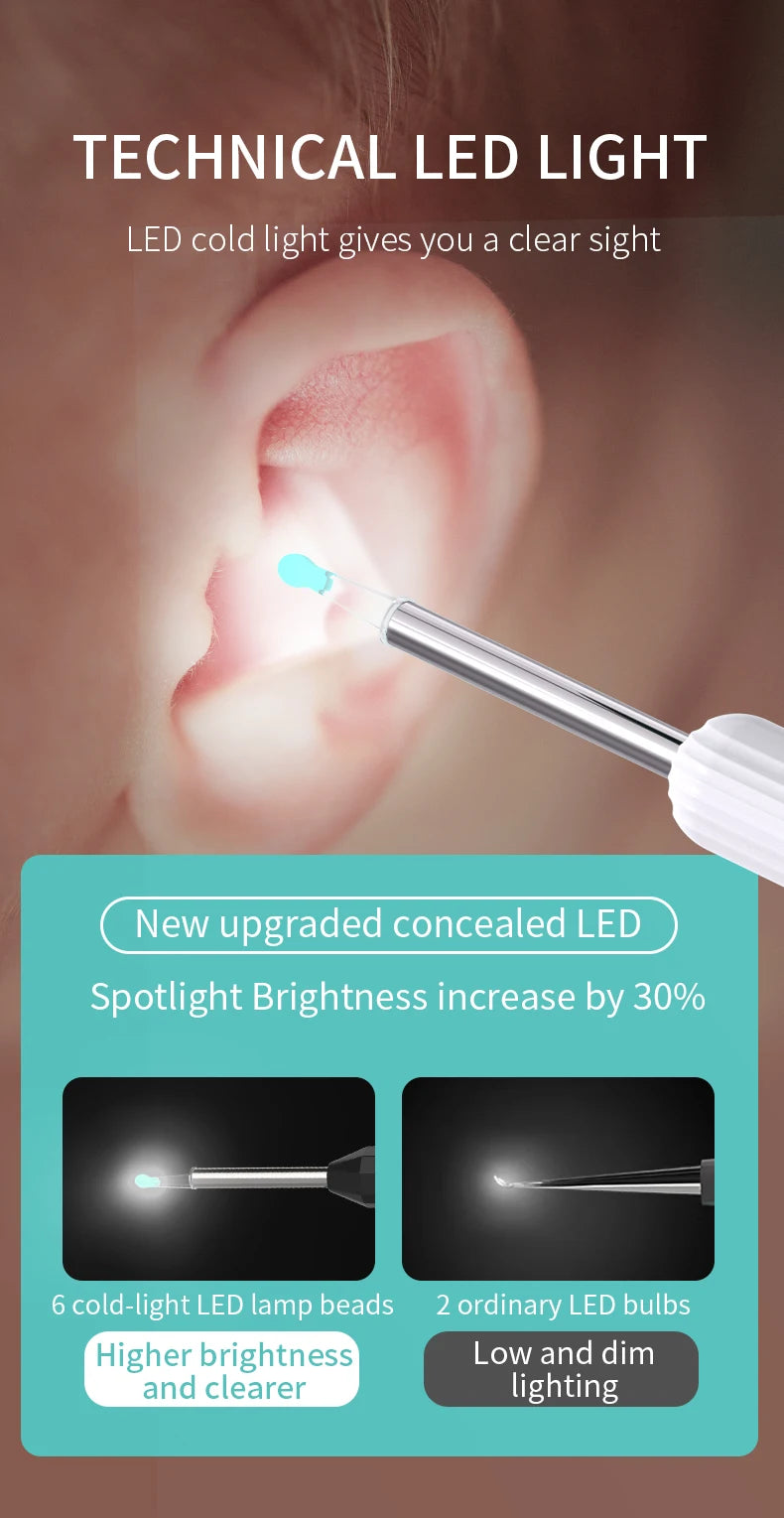 Smart Visual Ear Cleaner with Camera & LED Light for Ear Wax Removal