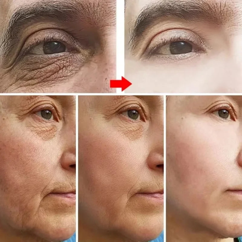 Retinol Face Cream – Anti-Aging, Firming & Wrinkle Removal Moisturizer