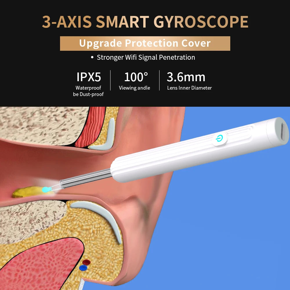 Smart Visual Ear Cleaner with Camera & LED Light for Ear Wax Removal