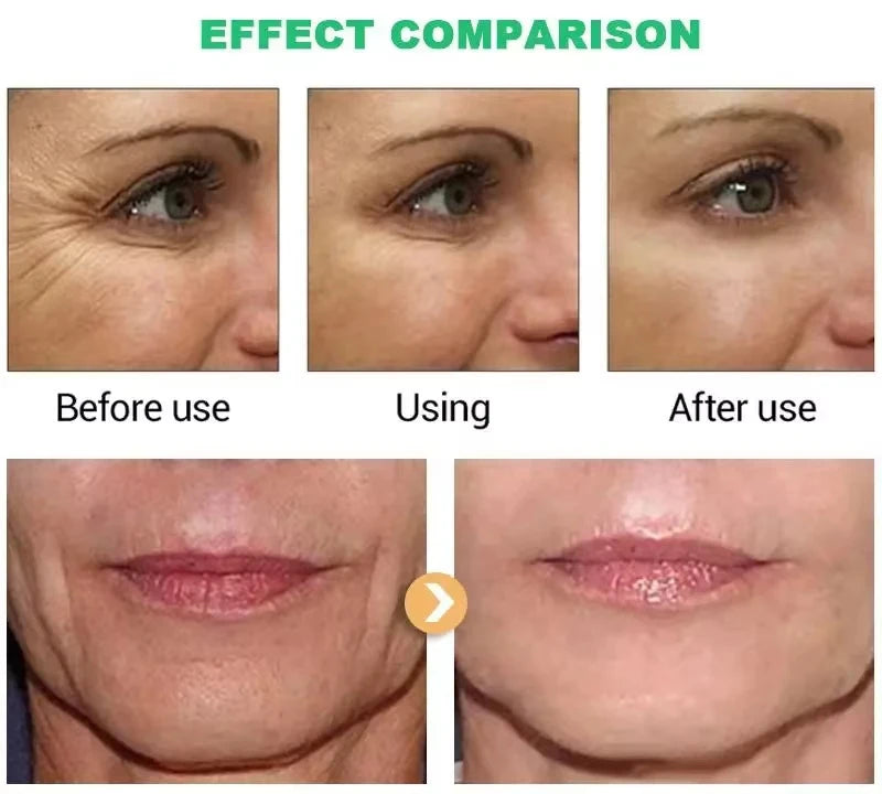 Retinol Face Cream – Anti-Aging, Firming & Wrinkle Removal Moisturizer