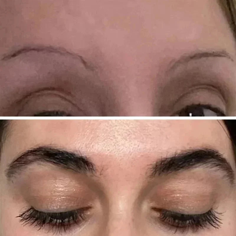 Eyebrow & Eyelash Growth Serum – Fuller, Thicker, Anti-Hair Loss