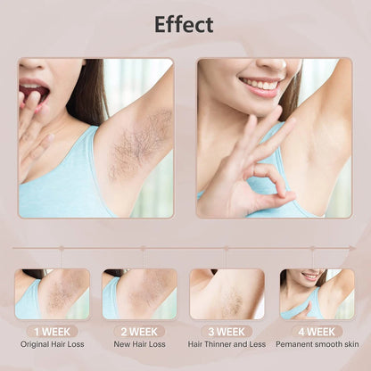 Laser Epilator IPL Hair Removal for Women