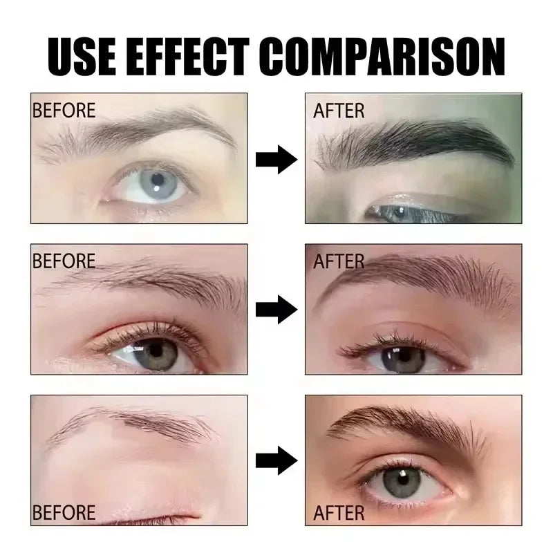 Eyebrow & Eyelash Growth Serum – Fuller, Thicker, Anti-Hair Loss