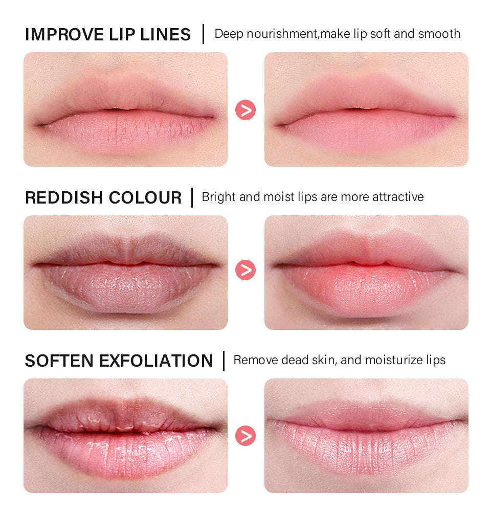 20g Night Lip Mask – Moisturizing, Lip Line & Lipitis Treatment
