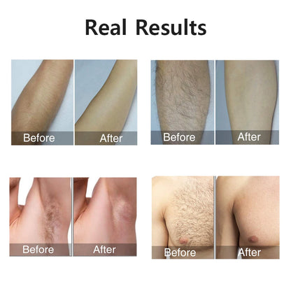 Laser Epilator IPL Hair Removal for Women
