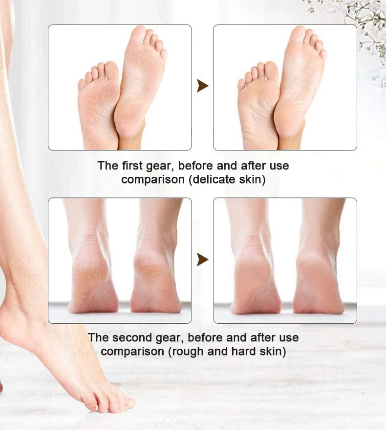 Rechargeable Electric Callus Remover | Waterproof Foot File