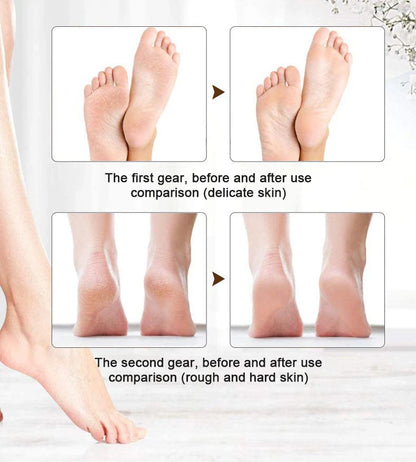 Rechargeable Electric Callus Remover | Waterproof Foot File