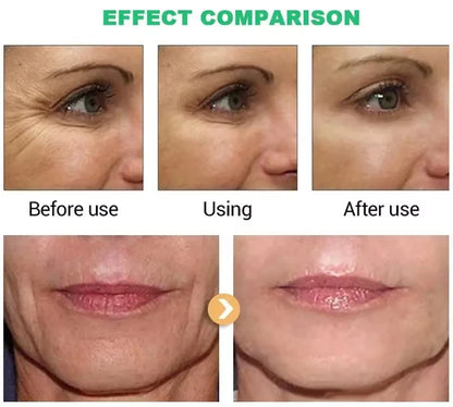 Retinol Face Cream – Anti-Aging, Firming & Wrinkle Removal Moisturizer
